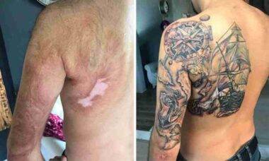 19 fotos mostram como a tatuagem pode transformar cicatrizes em obras de arte