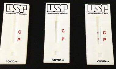 Pesquisadores da USP desenvolvem "Teste Popular de covid-19"