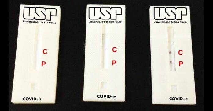 Pesquisadores da USP desenvolvem "Teste Popular de covid-19"
