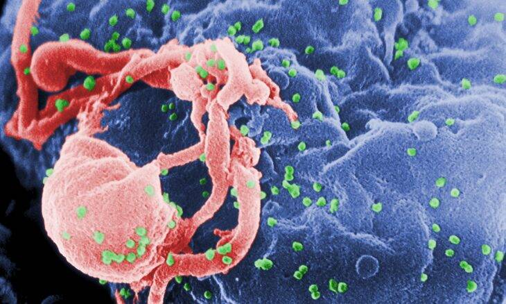 Vacina contra HIV atinge resultados promissores na fase 1