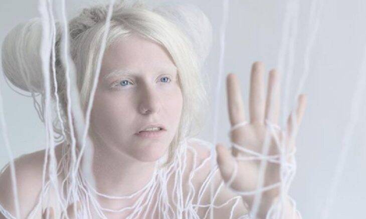 Fotógrafa viaja o mundo para registrar a beleza das pessoas com albinismo