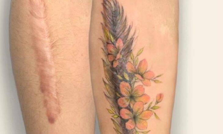 Tatuadora usa seu talento para esconder cicatrizes